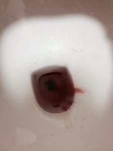 上厕所流血但不是月经 狗会来月经会流血吗