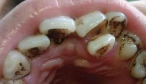 牙齿变黑是什么原因 小狗狗牙齿怎么变黑了呢