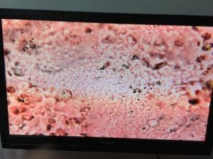 显微镜看狗狗卵角化细胞 初级卵母细胞显微镜图