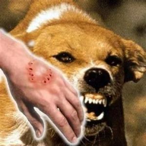 狗狗咬人怎么回事 狗狗有时咬到手指怎么回事