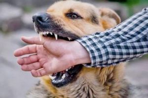 被狗狗咬伤表皮后，应采取哪些措施进行处理呢？