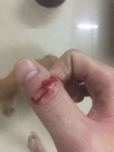 当手被狗狗咬出血时，应采取以下措施：