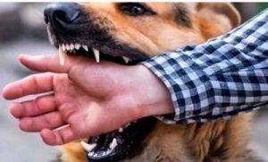 为何狗狗敢于攻击我：深入探究狗咬人的原因及防范措施
